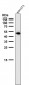 Anti-Phospho-Vimentin (S39) Rabbit Monoclonal Antibody